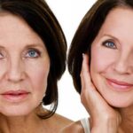 facelift-surgery-aftercare-Anthony-Macquillan-plastic-Surgeon