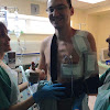 Pete Burch Google Review Image Arm lift Surgery Review Image 1